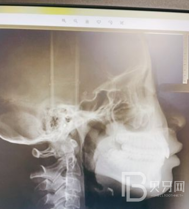 深圳瑞爾齒科做牙齒矯正靠譜嗎？