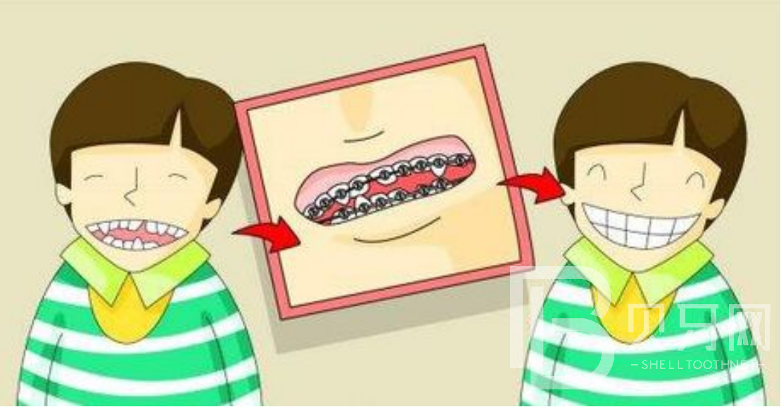 孩子牙齒不齊可以做牙齒矯正嗎？