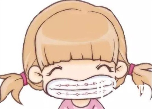 上海鑫齒口腔牙齒矯正好嗎？時代天使和隱適美有效果差別嗎？