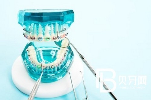 北京中諾口腔醫(yī)院靠譜不？中諾口腔牙齒矯正費(fèi)用高嗎？