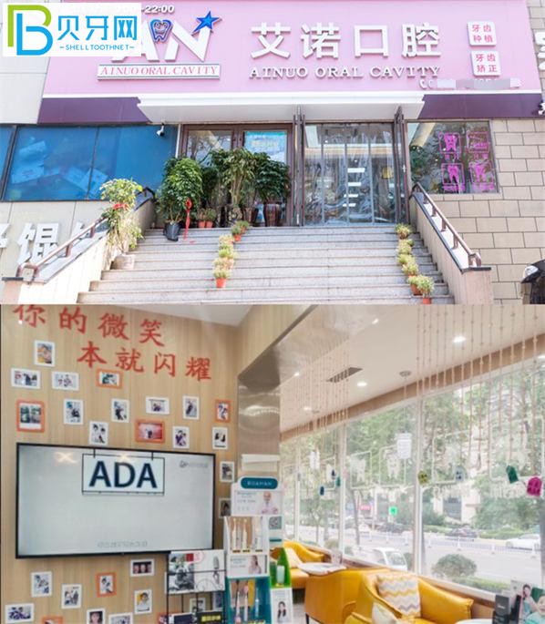 青島艾諾口腔怎么樣 艾諾口腔參考價(jià)格