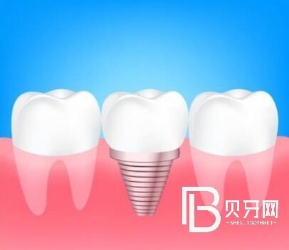 杭州博泰口腔口碑怎么樣？醫(yī)院正規(guī)嗎？