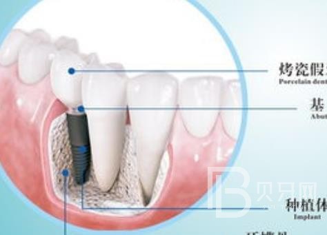 廣州優(yōu)德口腔正規(guī)靠譜嗎？廣州優(yōu)德口腔醫(yī)院位置在哪？