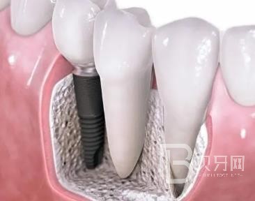 廣州牙美佳口腔正規(guī)靠譜嗎？廣州牙美佳口腔醫(yī)院位置在哪？