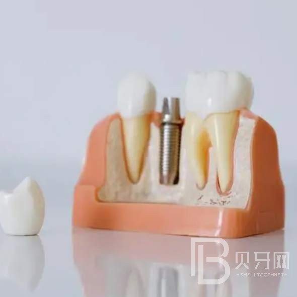 杭州牙齦紅腫最好的口腔醫(yī)院排行榜！杭州容勝口腔門診部業(yè)內(nèi)威望高！