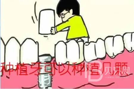 allon6種植牙是什么意思？東莞拜爾口腔